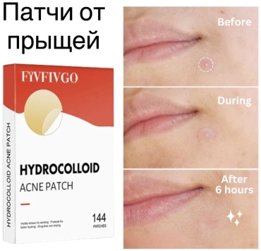 Патчи для тела От прыщей 7 г