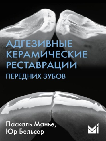 Бельсер Ю., Манье П.: Адгезивные керамические реставрации передних зубов. 4-е изд